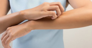 Sedam jeftinih i prirodnih trikova koji će otjerati komarce Sedam jeftinih i prirodnih trikova koji će otjerati komarce